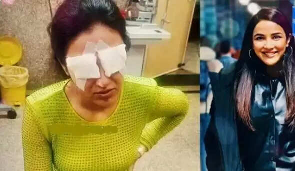 ஃபேஷன் எந்தளவு வாழ்க்கையை சீரழிக்குது பாருங்க! கண் பார்வையை இழந்த சிம்பு பட நடிகை.. இவங்களா?